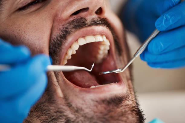 Laser Dentistry in Hayden, ID